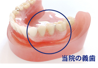 当院の義歯
